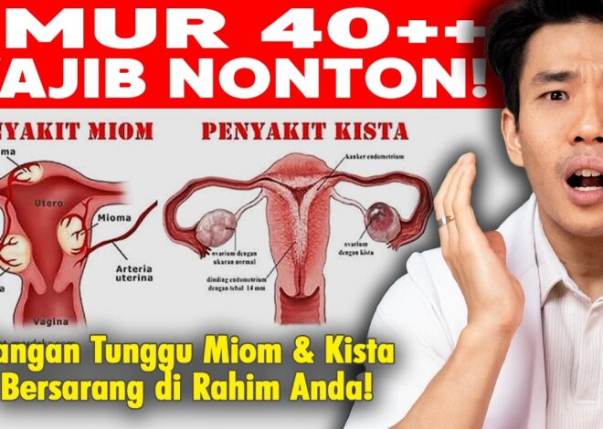 Ini yang Perlu Dilakukan Untuk Menghindari Mioma dan Kista