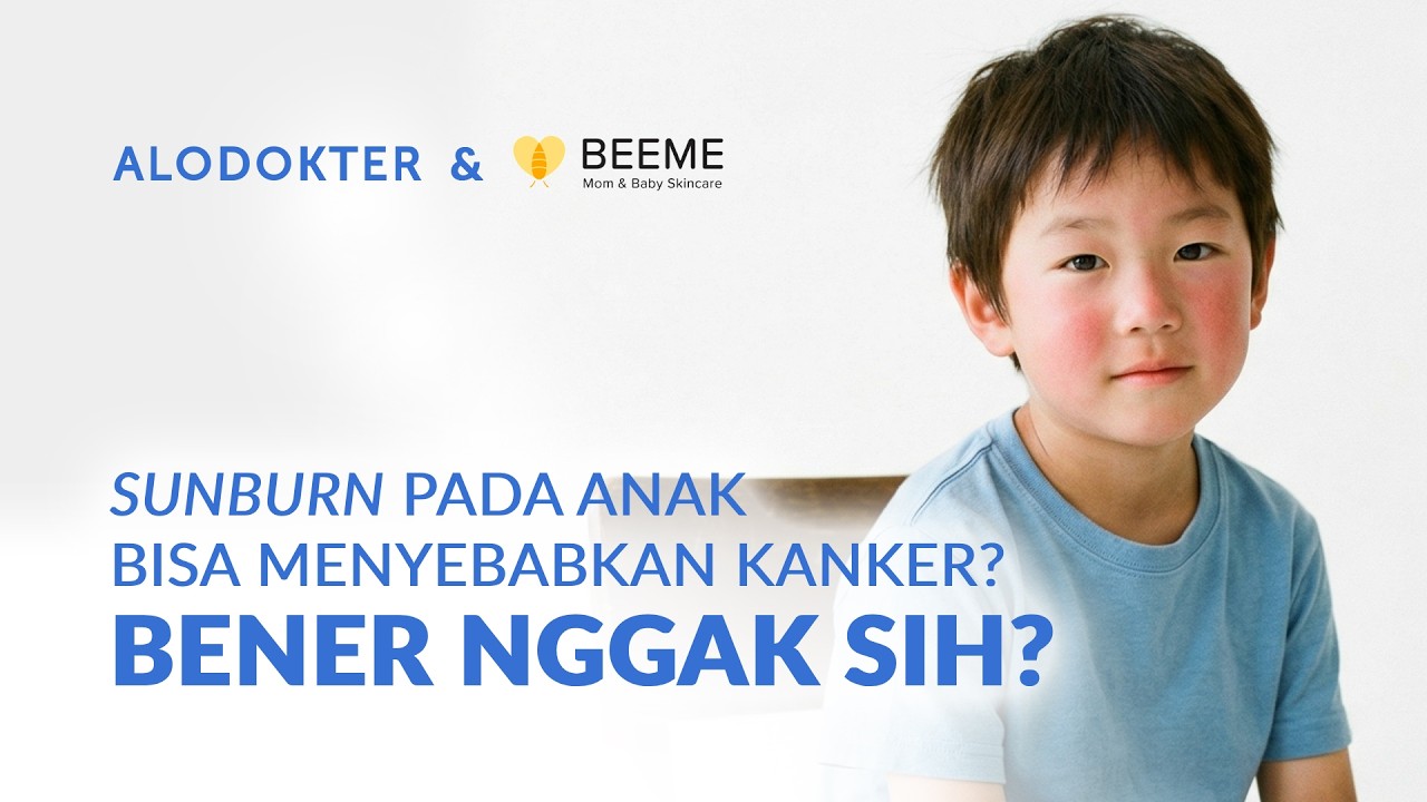 Sunburn pada Anak Bisa Menyebabkan Kanker? Bener Nggak Sih?