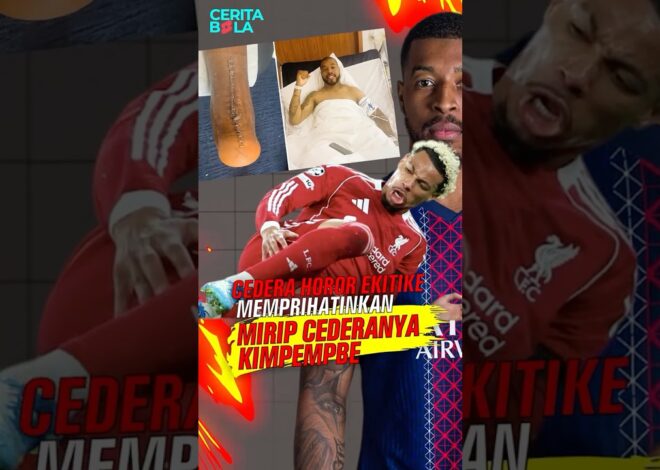 Horor! Cedera Ekitike Mirip dengan Kimpembe dulu absen sampai 1,5 tahun