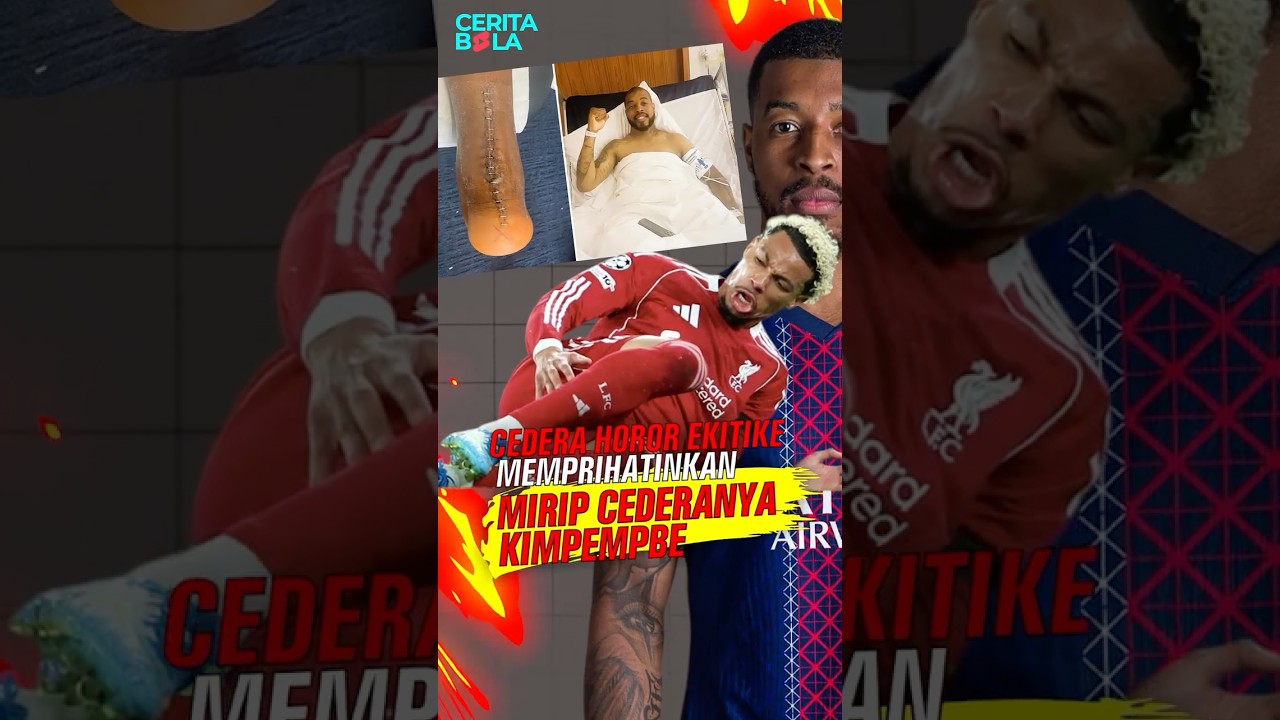 Horor! Cedera Ekitike Mirip dengan Kimpembe dulu absen sampai 1,5 tahun