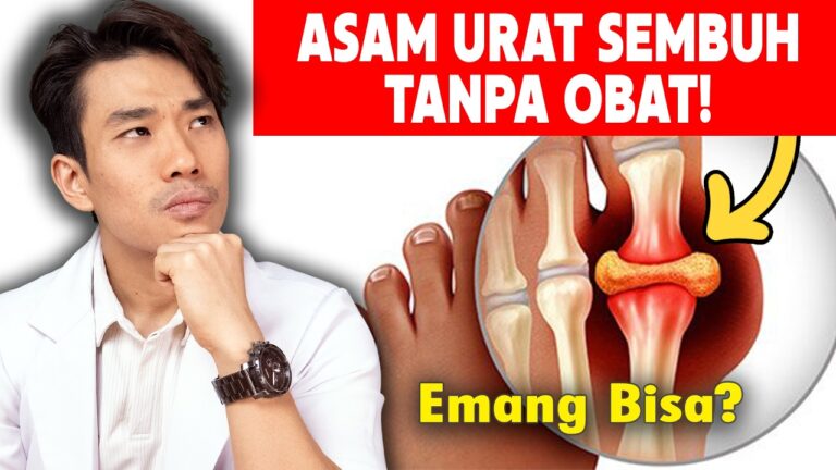 Youtube Thumbnail image of : Asam Urat Sembuh Tanpa Obat Konsumsi Makanan Ini!