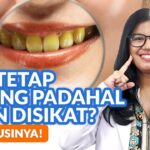 Youtube Thumbnail image of : Rajin Menyikat Gigi Tapi Warna Gigi Masih Kuning? Begini Cara Memutihkannya!