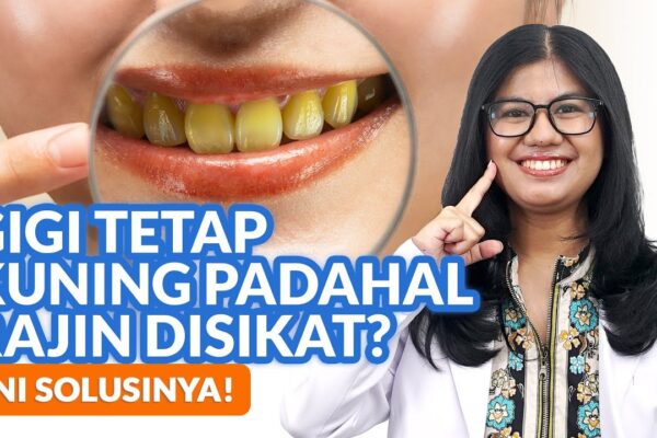 Youtube Thumbnail image of : Rajin Menyikat Gigi Tapi Warna Gigi Masih Kuning? Begini Cara Memutihkannya!